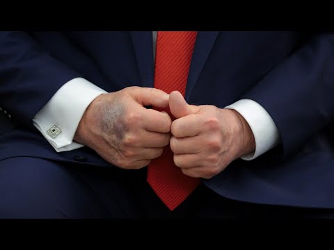 ‘I don’t want thick blood’: Trump takes more aspirin than advised